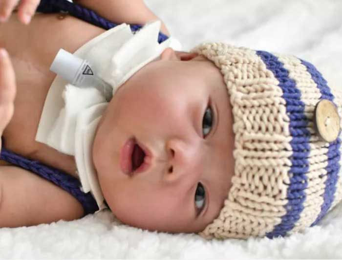 Smiling baby boy with a trach