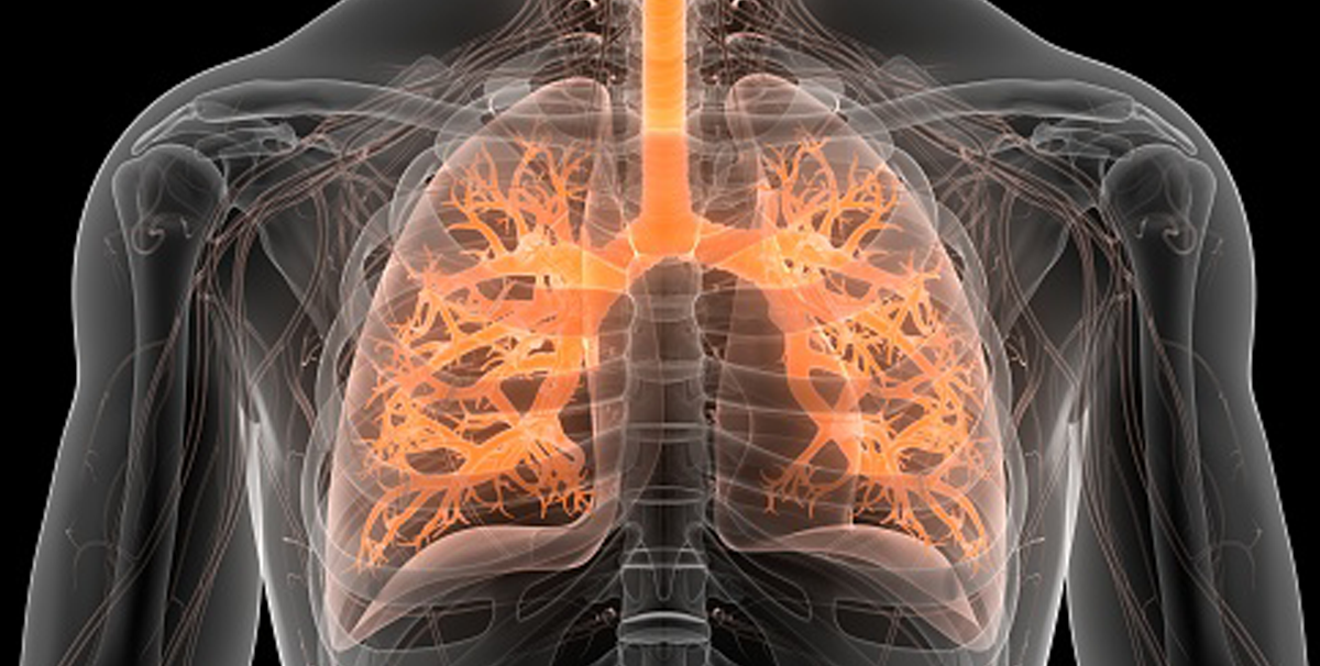 Endeavor Health, Northwestern Develop AI Program to Detect Lung Disorder. A digital scan of a patient's chest highlights the lungs' airways.