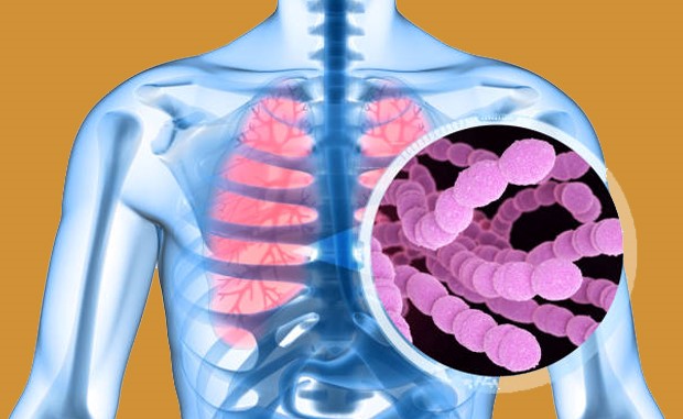 Weigh In Social Factors Along with Clinical Conditions When Predicting Sepsis Risks. A scan of a patient's chest showing inflamed lungs with a close up image of a bacterial infection.