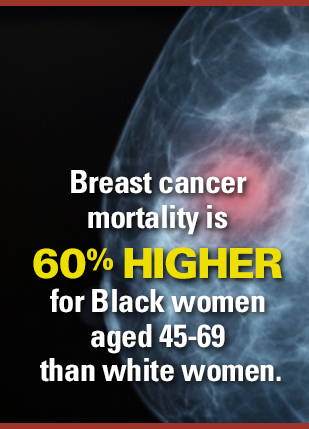 Infographic: Breast cancer mortality is 60% higher for Black women aged 45-69 than white women.