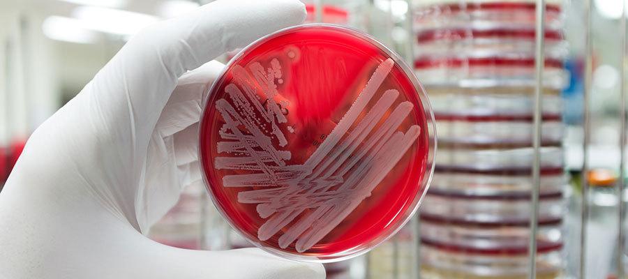 anitbiotic resistance