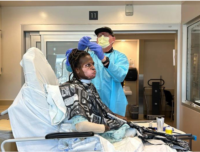 Aaron Brazier helps amputee patient June Cary with his dreadlocks