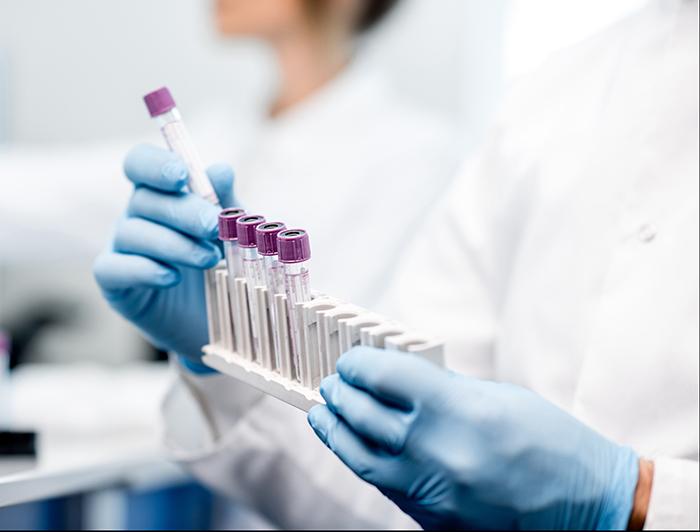 Stock photo of lab worker wearing white lab coat and latext gloves, handling test tubes
