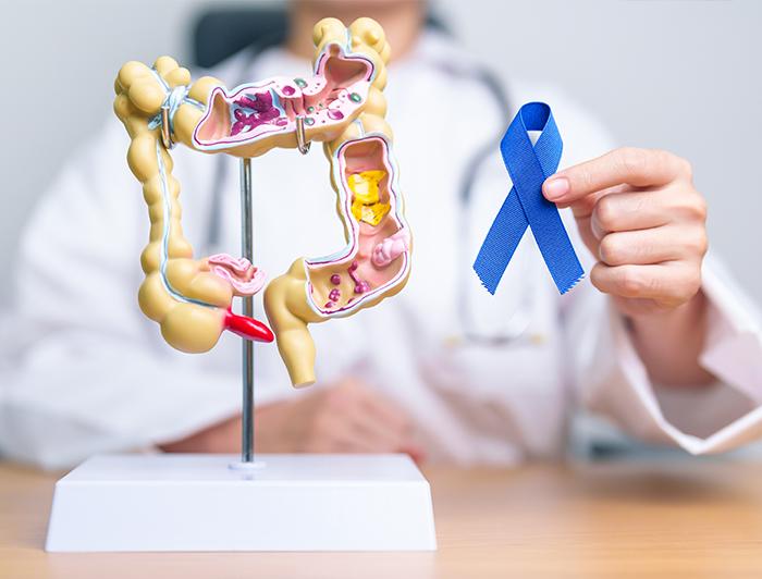 Stock image of a doctor in white coat sitting behind a model colon, holding up a blue ribbon