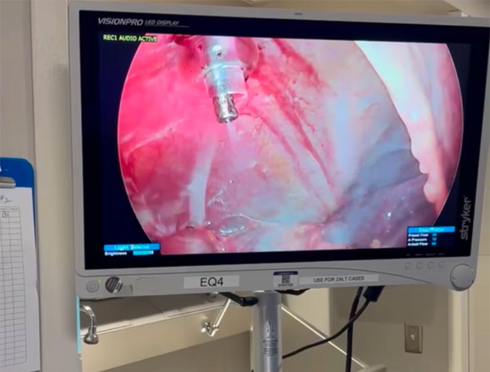 Large monitor showing chemo treatment in process